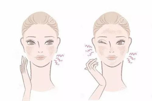 一、敏感肌肤的特点与防晒需求