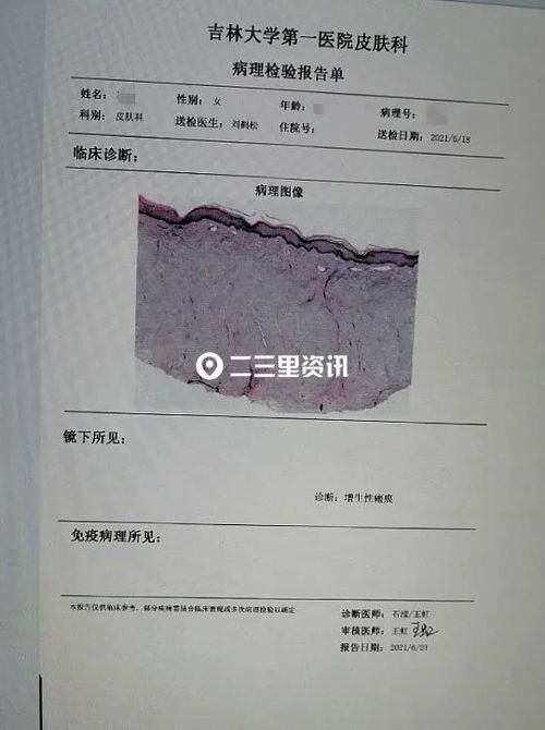 一、疤痕修复术概述