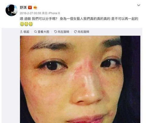 一、过敏脸图片的特点与识别方法