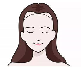 一、发际线调整后的不适应感