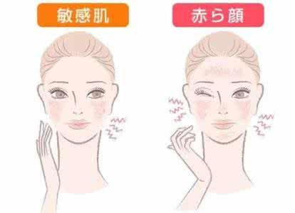 一、了解敏感肌肤的特点