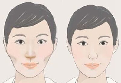 一、高颧骨的成因与特点
