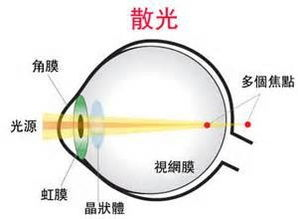 一、了解闭口形成的原因