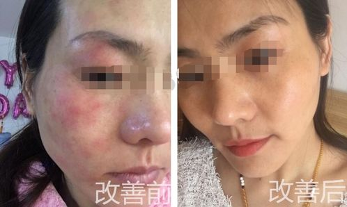 一、认识敏感彩妆的重要性