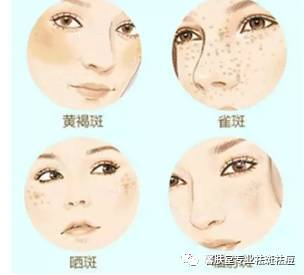 一、了解祛斑成分的有效性