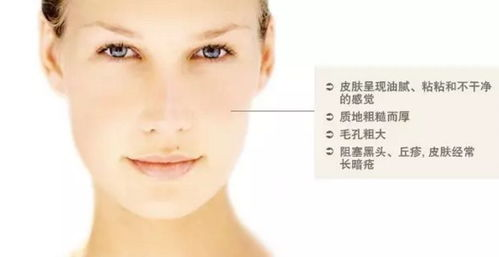 一、认识油性皮肤的特点与需求