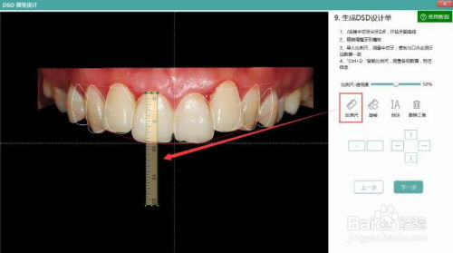 三、口腔软件的优势