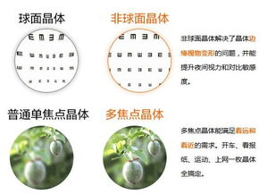 人工晶体更换手术的基本费用构成