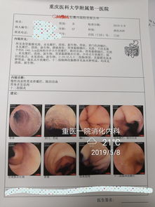 胃镜检查的基本费用构成