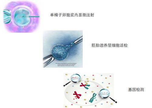 试管婴儿基础费用构成