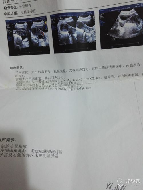 B超检查的基本价格范围