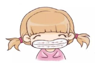 牙套价格的主要影响因素