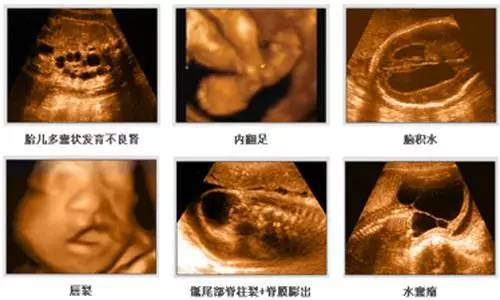 四维检查的基本价格范围