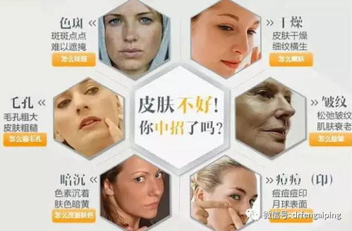 激光美容价格影响因素概述