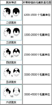 种植头发价格概述