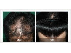 种头发费用的基本构成