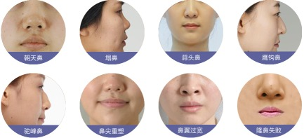 整容手术价格的基本构成
