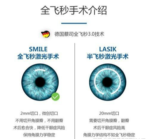 激光治疗近视的基本费用构成