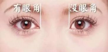 开眼角手术的基本价格范围