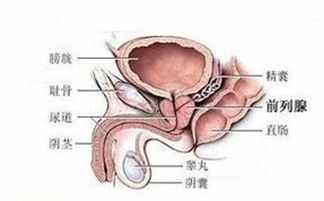 前列腺手术的基本类型与费用范围