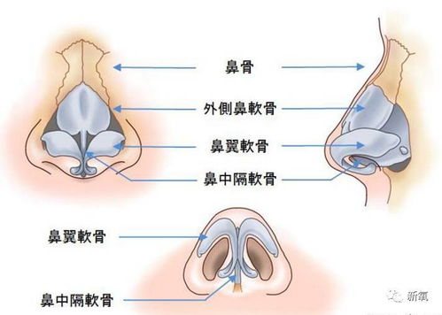 鼻子整形手术费用构成与市场现状