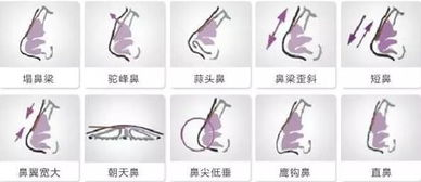 垫鼻梁手术的基本价格范围