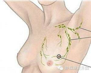 腋下副乳手术的基本费用构成