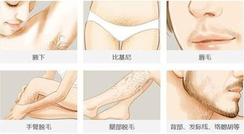 激光脱毛的基本费用构成