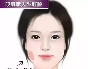 瘦脸针市场价格区间与影响因素