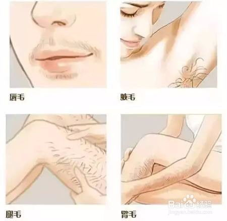 脱毛价格影响因素解析