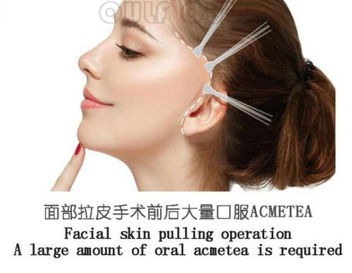 拉皮手术价格构成：基础费用与附加项目