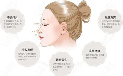软骨隆鼻的基本价格构成