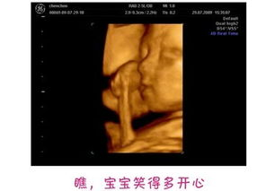 妇科彩超的基本价格构成