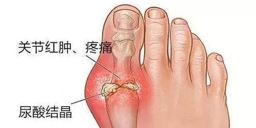 一、水泡成因及症状