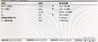 五、异常延迟情况的排查与解决