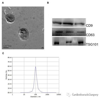 二、 静电防护非玄学,小疏忽毁千元硬件