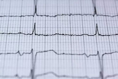 第三章: 生命线交织与心跳重启——理线、接线与点亮调试