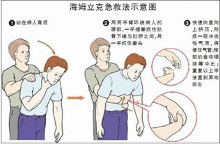 四、宝宝双腿往上翘的常见误解