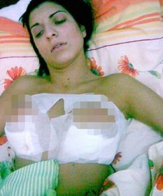 一、隆胸大小的标准