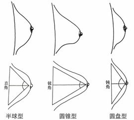 三、圆锥形胸型手感